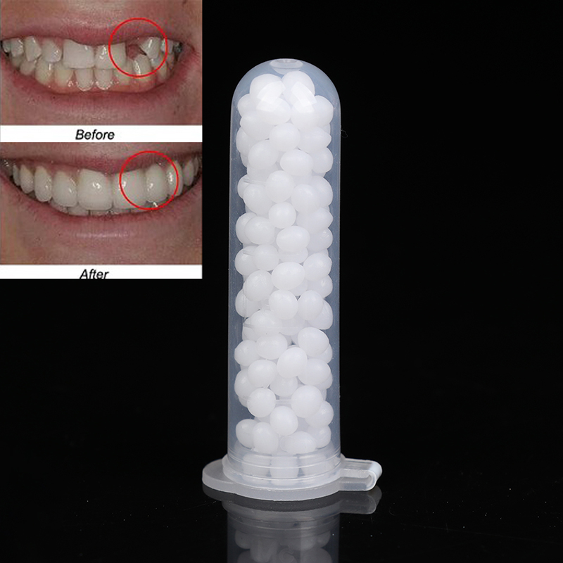 【K】1 коробка набора для времен – обзор и цена Teeth Whitening Kit